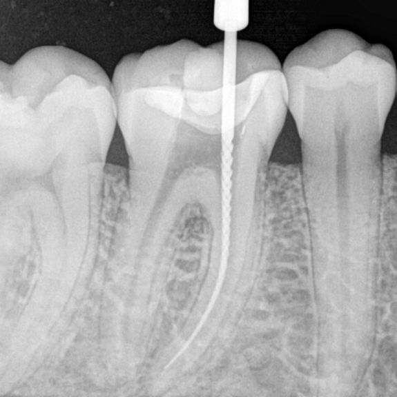 Eskişehir Endodonti – Oldcitydent
