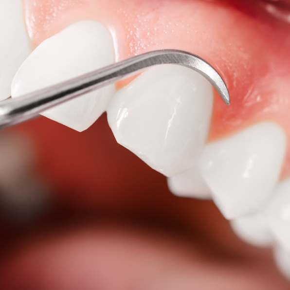 Eskişehir Periodontoloji – Oldcitydent