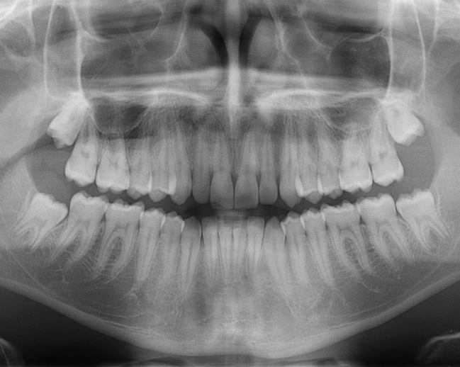 Eskişehir Ağız, Diş ve Çene Radyolojisi – Oldcitydent
